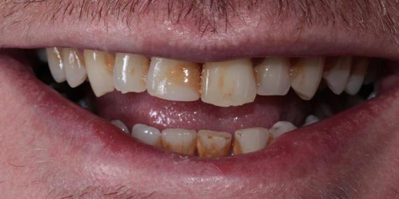 Book Your Next Dental Check-Up in Manchester Today