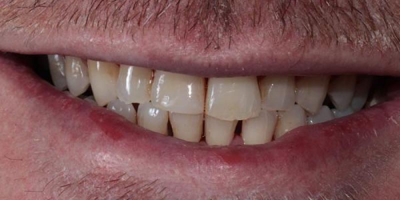 Book Your Next Dental Check-Up in Manchester Today