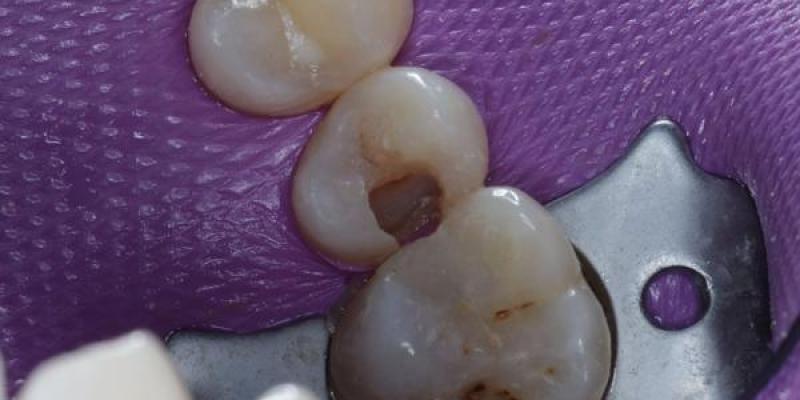 Book Your Next Dental Check-Up in Manchester Today