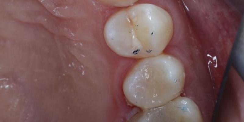 Book Your Next Dental Check-Up in Manchester Today