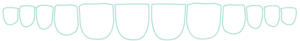 Composite Bonding